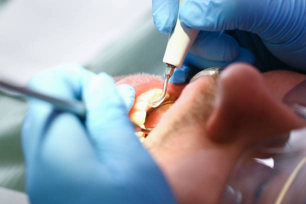 Best Emergency Dentist for Knocked-Out Tooth in Prosser, WA