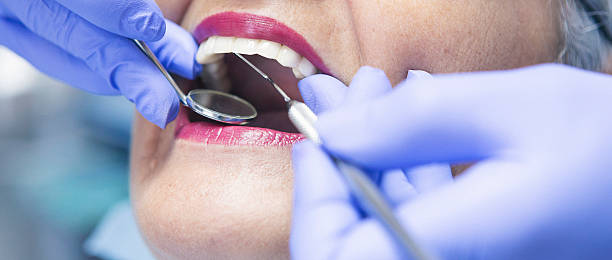 Best Emergency Dental Services for Seniors in Prosser, WA